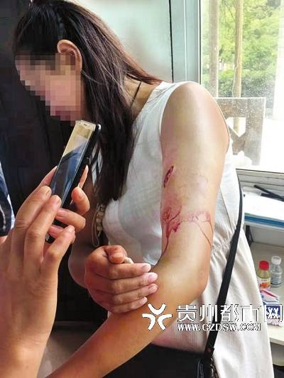 一名女游客被猕猴咬伤左手，疼得直哭。资料图