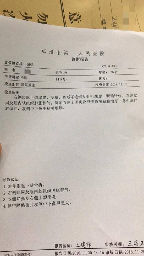 今年11月29日，润妍遭到冀学家暴，致眼眶骨折。