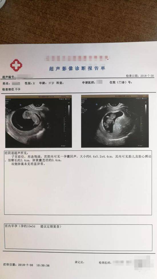 2018年7月，小滚珠的一次诊断报告，孩子第一次有了清晰的人形。受访者供图