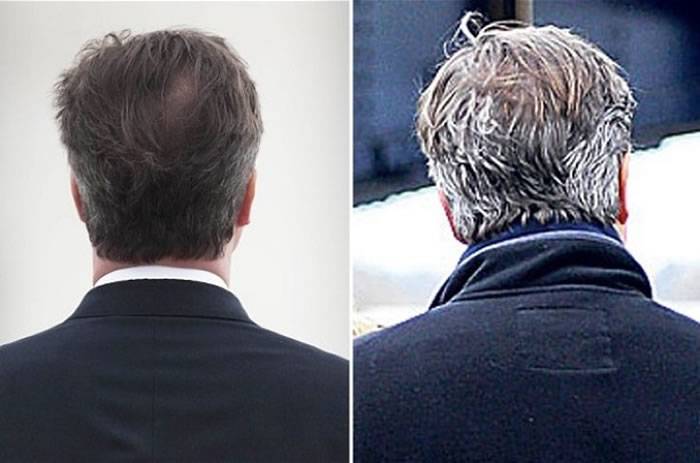 英国首相卡梅伦后脑位置的头发变得稀疏。图左摄于2010年，图右摄于2014年。