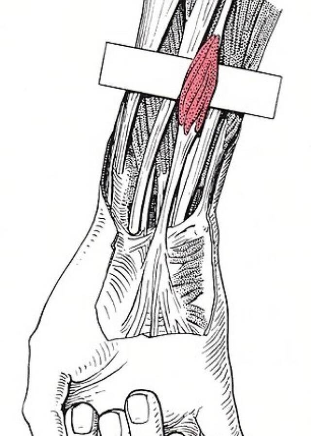 红色的部分就是掌长肌。