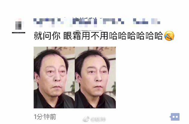 网友为苏大强去眼袋