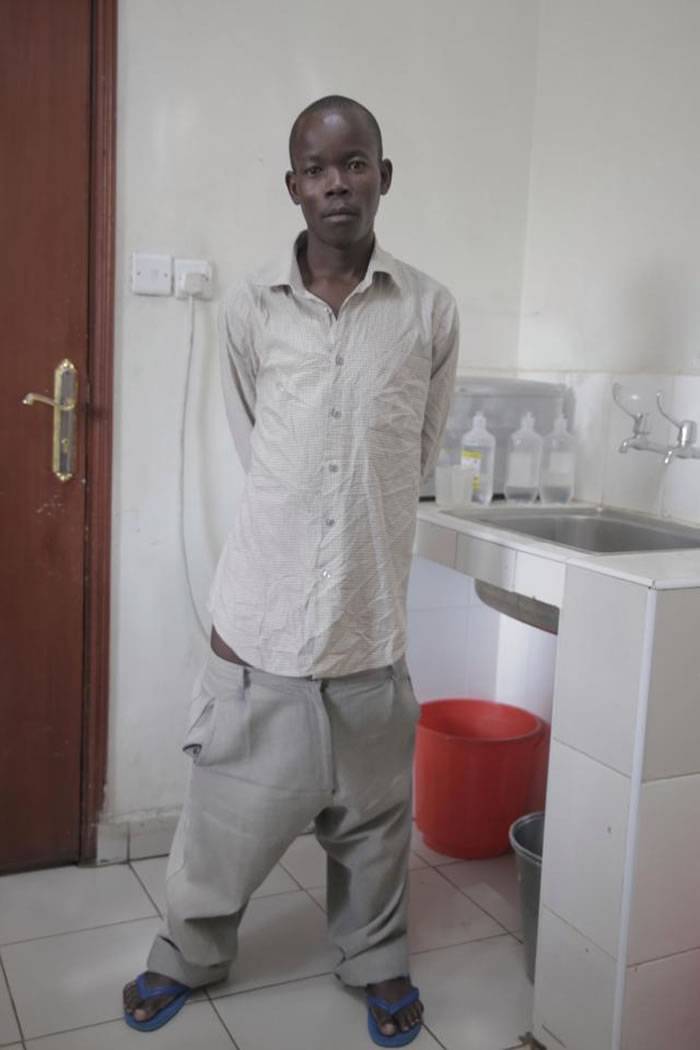 肯尼亚男子罹患怪病睾丸是一般人的10倍大