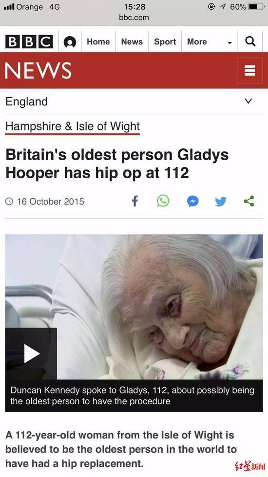 英国112岁老人接受了髋关节置换手术，创下世界纪录