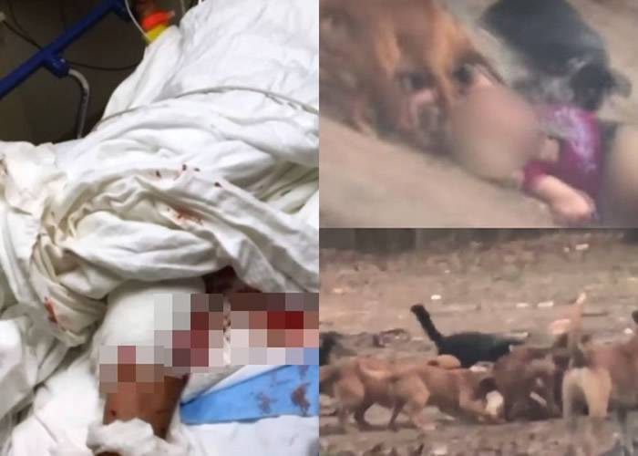 美国阿肯色州27岁女子外出散步遭一群狗围攻咬至遍体鳞伤