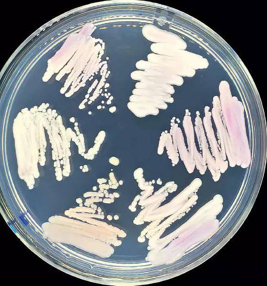 上海市医学真菌分子生物学重点实验室用科马嘉念珠菌显色培养基鉴定国内外耳念珠菌，均呈现出粉色。也有研究表示，耳念珠菌在培养基中会呈现白色，这主要与不同耳念珠菌菌株特征或培养基的染色剂有关。图/受访者提供