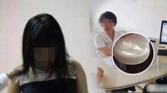 22岁未婚女孩却有母乳 一查是减肥药惹的祸