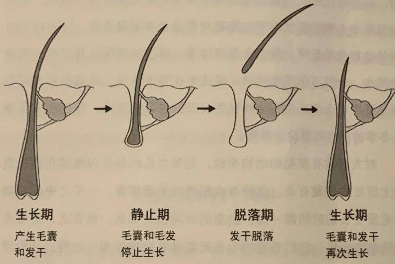 “秃”然的自我：发际线后移，如何安好？