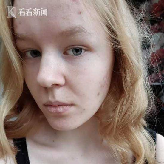 荷兰少女三遭施暴难释怀获准安乐死？这才是真相