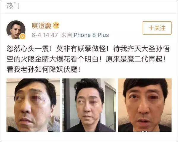 歌手庾澄庆“血眼”吓懵网友 医生却说这病很常见