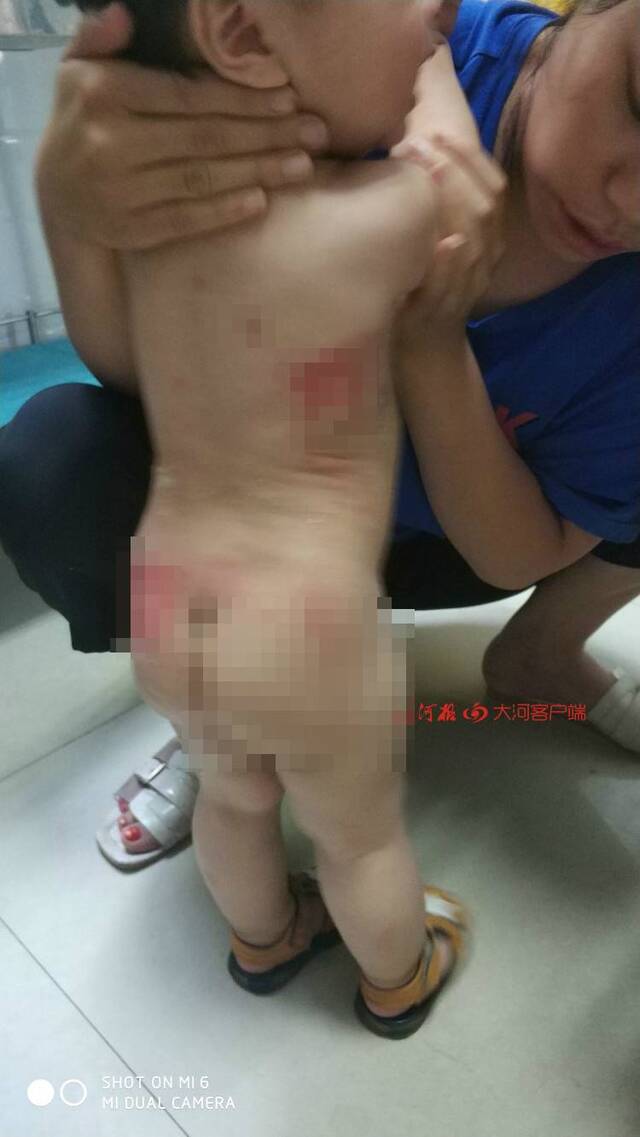 孕妇向1岁女婴泼麻辣烫 因怀孕不执行行政拘留