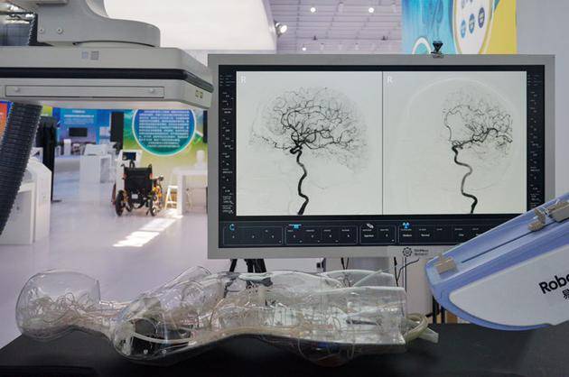 高精度微创血管介入手术机器人。新京报记者郑新洽摄