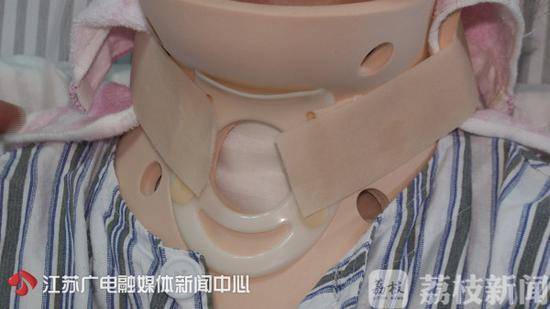 还在“埋头”工作？28岁女孩颈椎退化严重险瘫痪