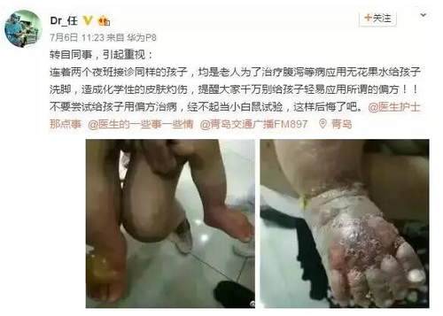 男子生吞一条活泥鳅险丢命 医生：第一次遇到(图)