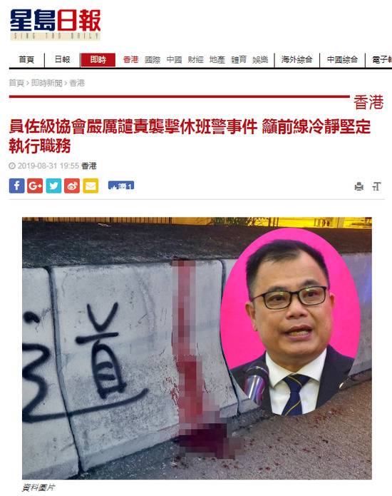 香港警察遭暴徒斩断4根手指 警员佐级协会发声明