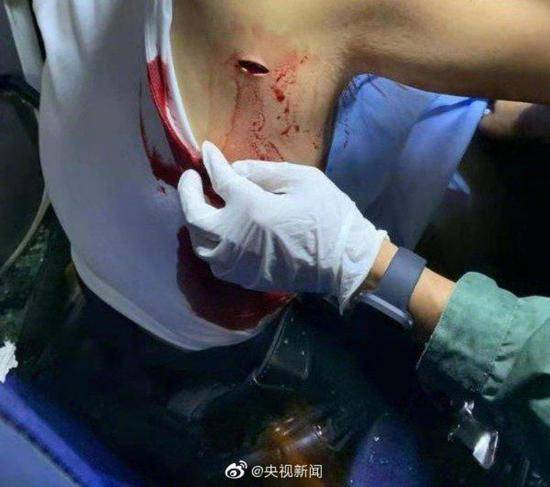 25日，一位香港警员在荃湾被暴徒刺伤背部
