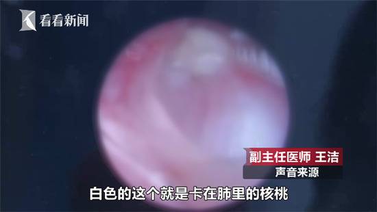 两岁男童咳嗽不止 医院拍片一看母亲吓到腿软(图)