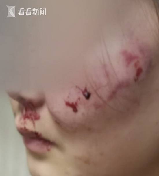 女孩拒绝搭讪遭殴打 施暴者事后淡定去跳广场舞