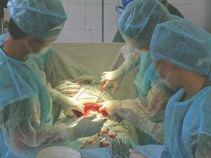 男婴出生4天后“剖腹产子” 都是寄生胎惹的祸