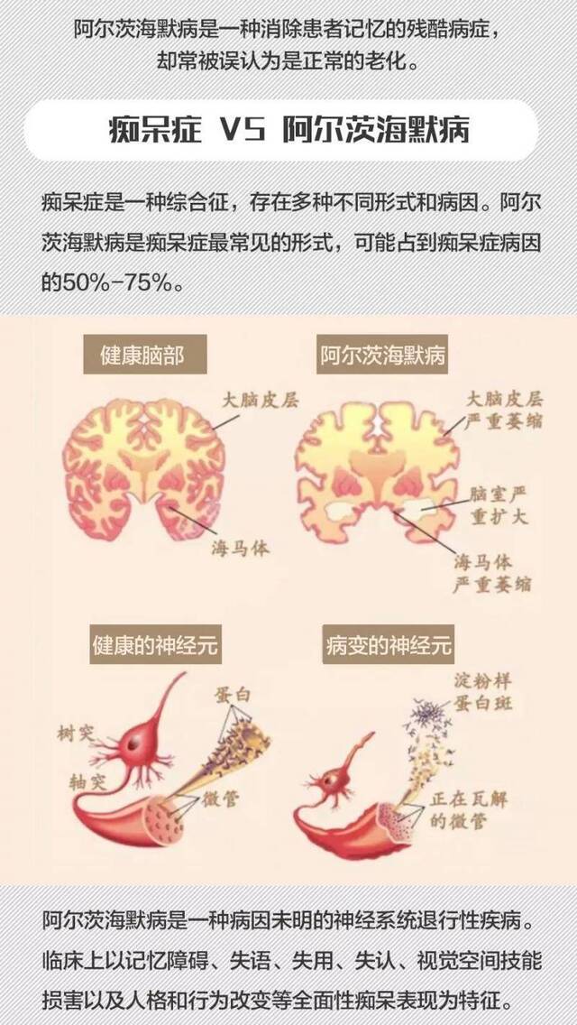 这种病被称为“记忆橡皮擦” 很多人却还不解它