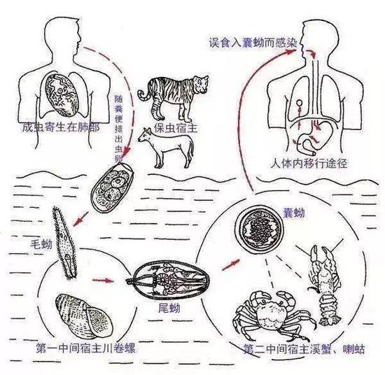 小伙吃螃蟹后肺和脑子被虫啃 这个教训现在看不晚