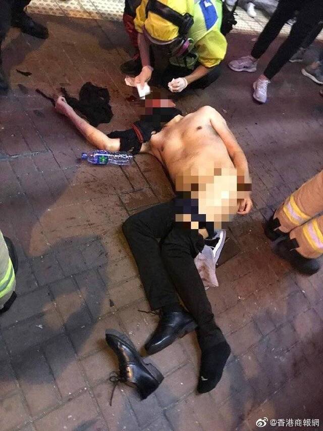 香港医管局：各区冲突有54人受伤，1人情况严重