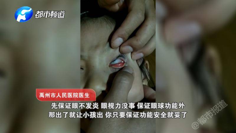 7岁女童眼睛被同学强塞纸片 一个月取出几十张