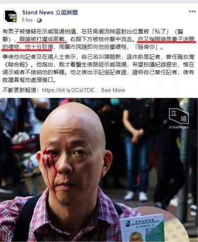 “人超好”的港籍台媒记者 也被香港暴徒殴打了