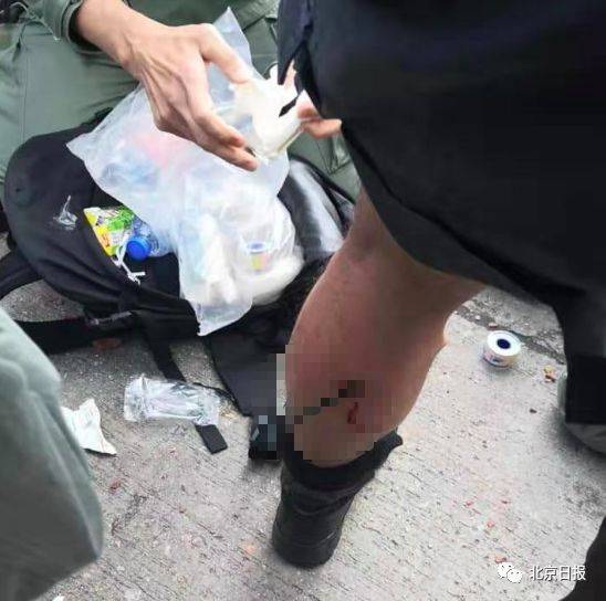 遭暴徒弓箭射腿钢珠击脸 香港警协提出个强烈呼吁