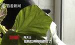 女子整牙牙套不慎落入肠子 连吃四天泻药痔疮复发