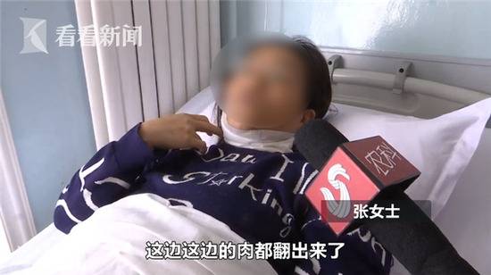 女子骑电动车被割伤缝了30多针 “元凶”原来是它