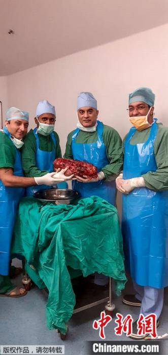 重达7.4公斤！印度医生从一患者体内切除巨型肾脏
