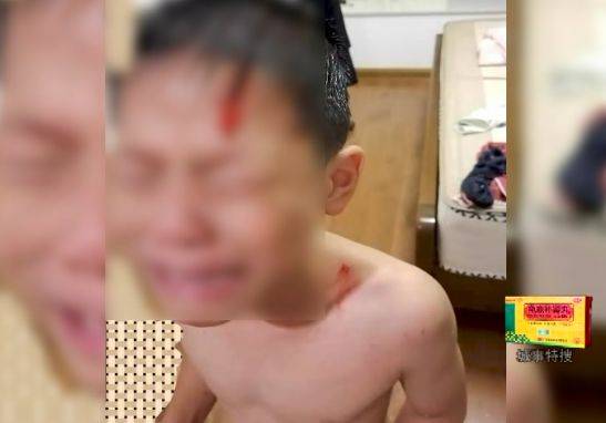 东莞7岁男童洗澡“被炸”，全身多处划伤，快检查你家浴室是否有这风险？