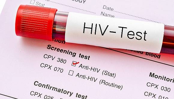 国内超30%感染者未被发现 HIV检测选尿检还是血检