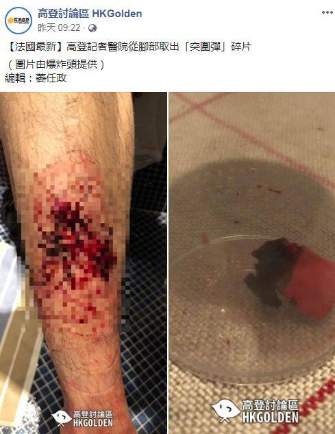 香港反对派记者自称被法国警察炸伤 网友：活该