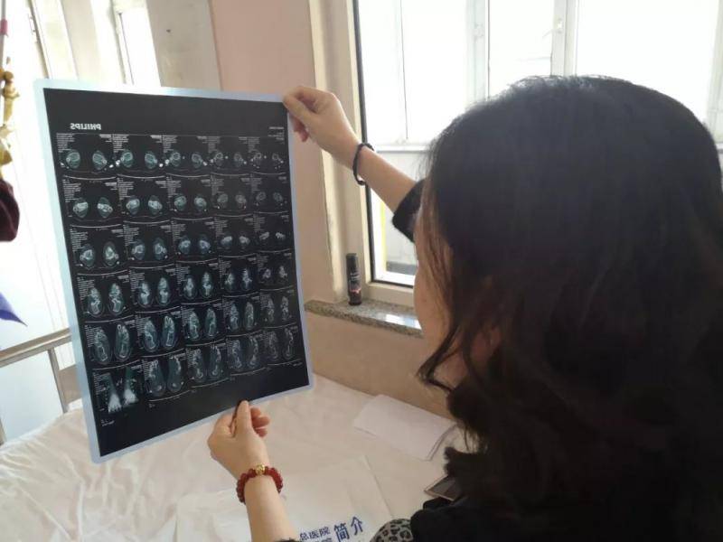 2019年1月21日，布病患者杨荣正在给记者展示她前不久刚拍的磁共振，脚踝周围有黑影。新京报记者吴靖摄