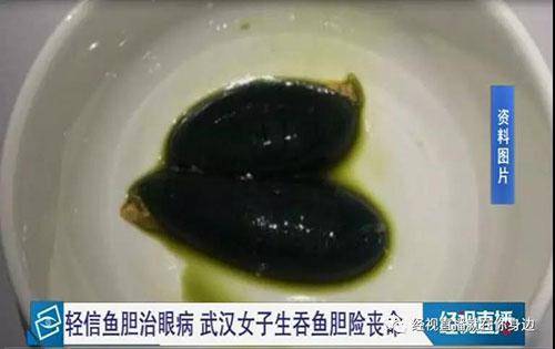 鱼胆明目？女子生吞鱼胆结果当晚肝衰竭住进医院