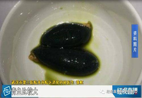 鱼胆明目？女子生吞鱼胆结果当晚肝衰竭住进医院