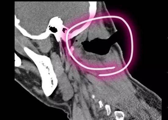 CT图上，患者的伤口很惊人