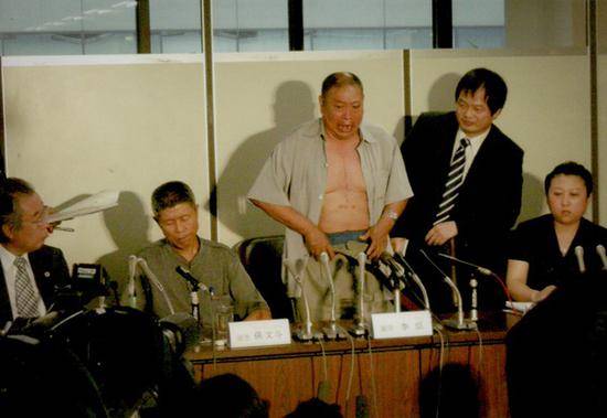 2007年7月18日，日本东京高等法院驳回了中国原告的全部诉求。图为李臣在开庭前的新闻发布会上脱裤，向记者展示毒气在身上留下的伤痕。