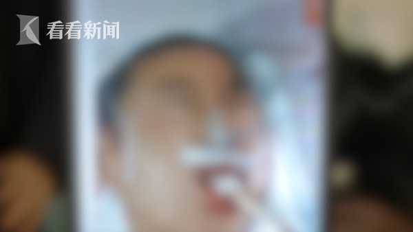 男孩发烧险成“植物人” 父母坚持不放弃换来奇迹