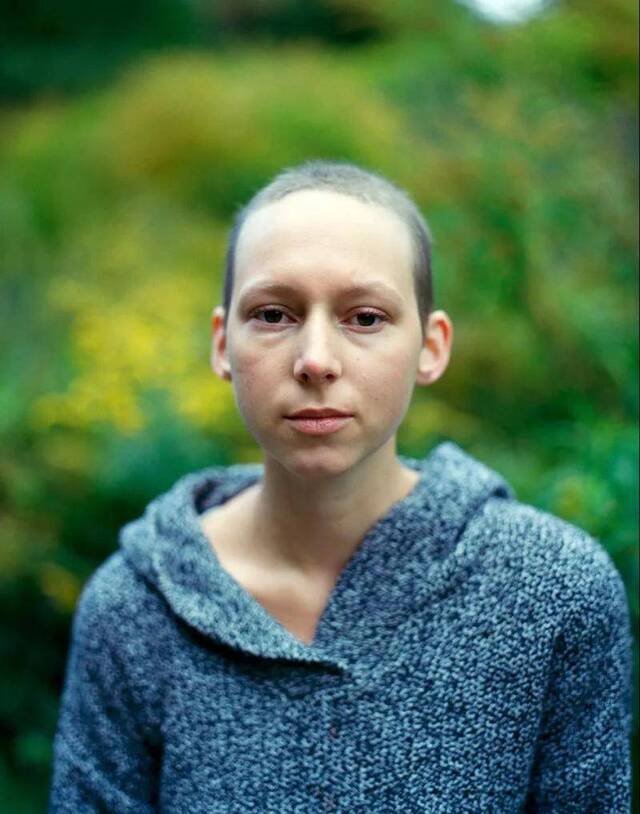 女摄影师自拍抗癌全过程：你无所畏惧的样子真美