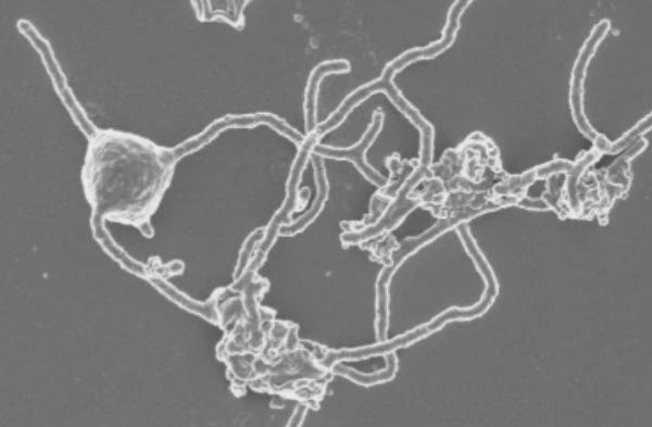 显微镜下的“阿斯加德”古菌（英国《自然》周刊）