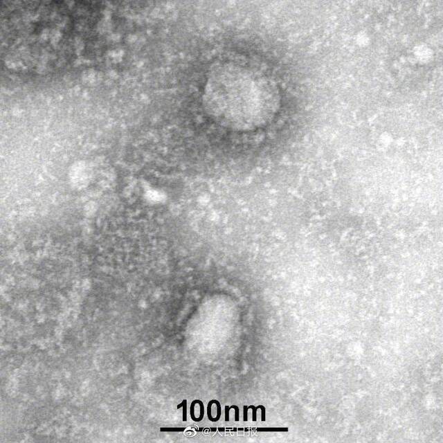首株新型冠状病毒毒种信息公布