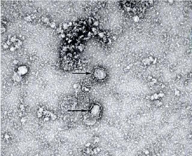 国家病原微生物资源库公布首株新型冠状病毒毒种信息