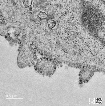 香港大学电子显微镜图像显示了在细胞中生长的新型冠状病毒。