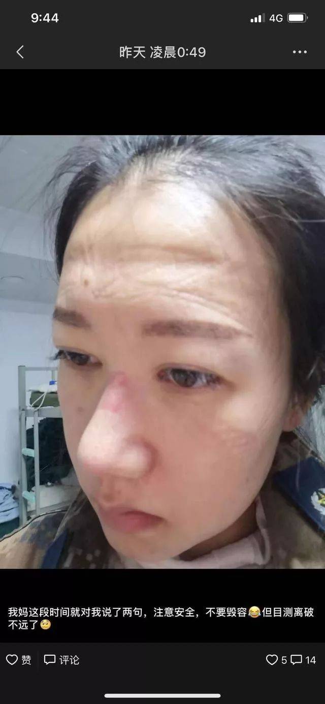 这张对比照刷屏网络后 母亲才知女儿去了疫情一线