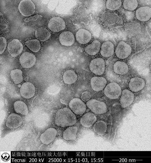 电子显微镜下SARS样冠状病毒粒子的形态结构（图片来源于中国科学院武汉病毒研究所杨兴娄副研究员）