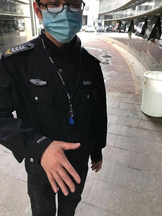 辅警徐攀右手虎口被刀刮伤