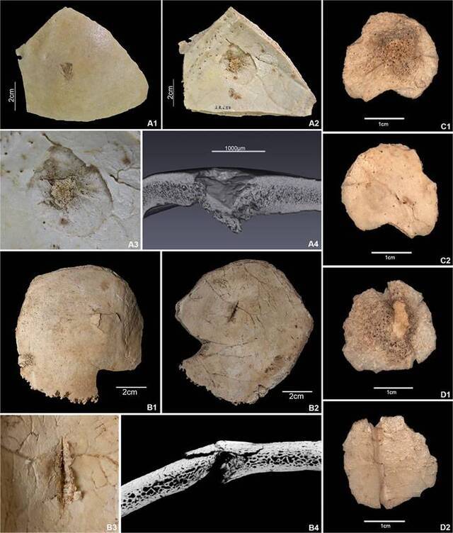 西班牙比利牛斯山脉El Trocs洞穴发现7300年前被残忍杀害的人类遗骸